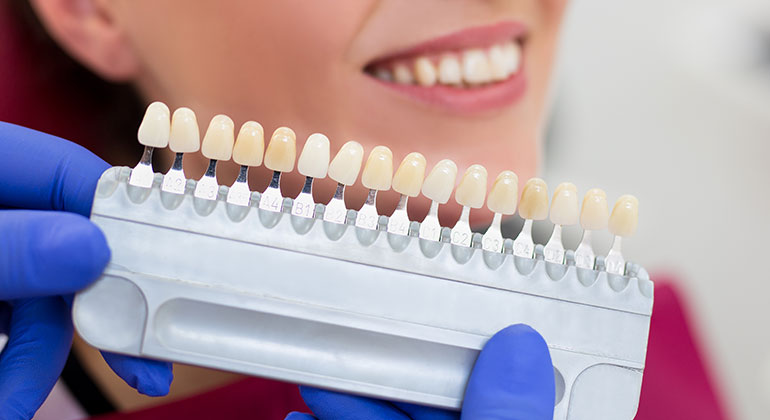 shades selector for veneers shells 