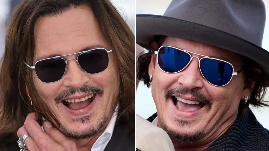 johnny Depp's teeth