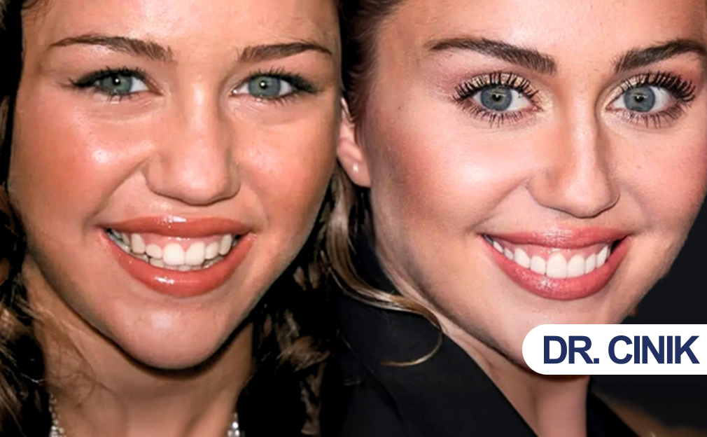 MİLEY CYRUS