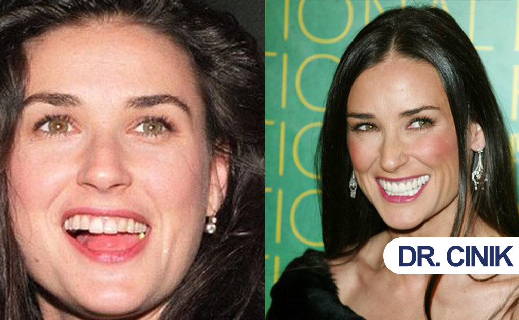 Demi Moore