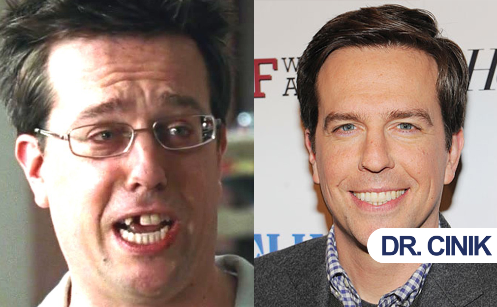 Ed Helms