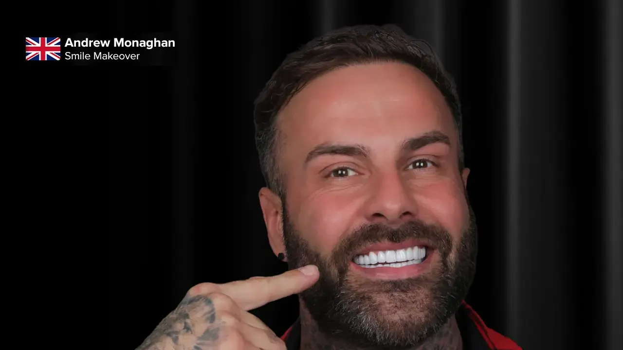 Andrew Monaghan's Zirconium Crowns Smile Makeover Andrew Monaghan's Zirconium Crowns Smile Makeover