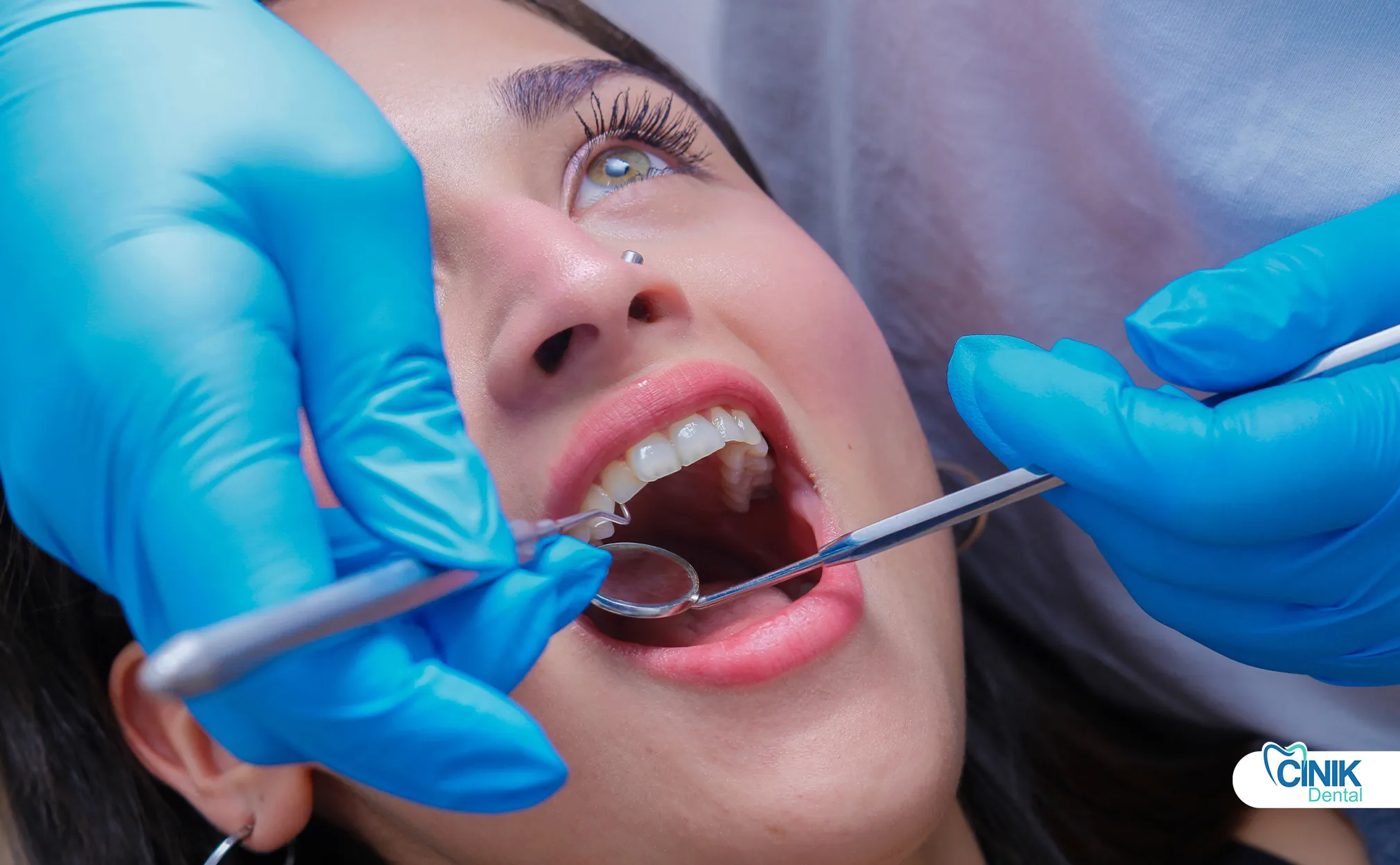 Que sont les facettes en stratifié ? Un guide scientifique sur les types, la procédure, les avantages et les comparaisons Que sont les facettes en stratifié ? Un guide scientifique sur les types, la procédure, les avantages et les comparaisons