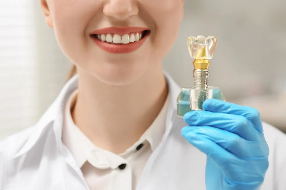 Os Implantes Dentários Vale a Pena? Os Implantes Dentários Vale a Pena?