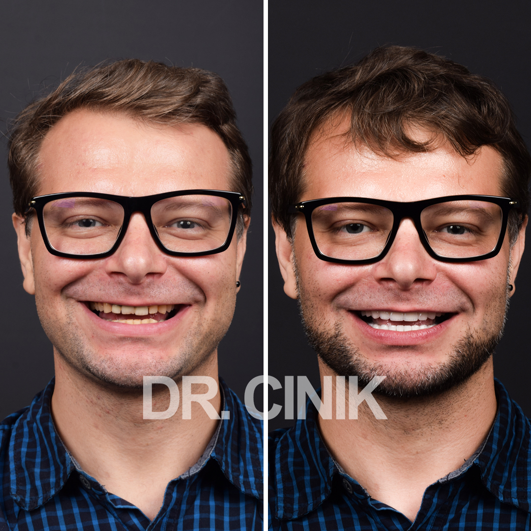 Beautiful smile transformation