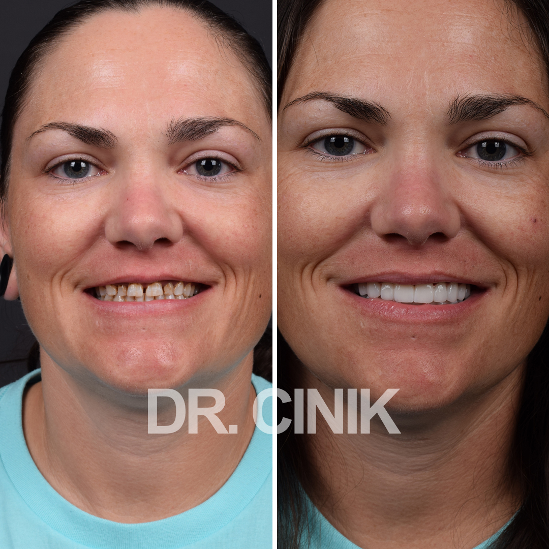 Happy patient result