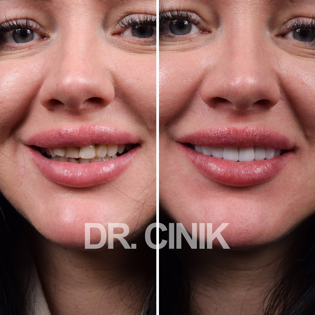 Happy patient result