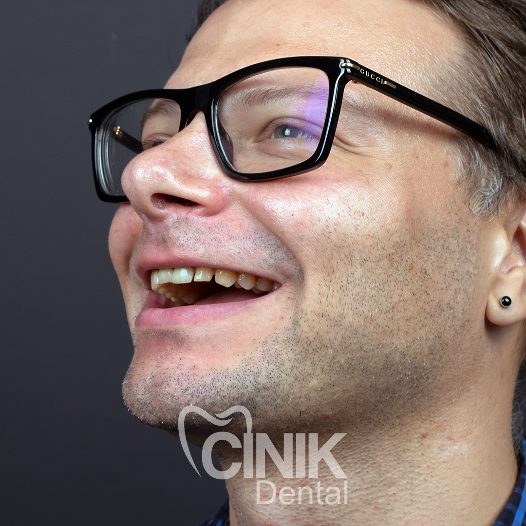 Aleksandr Shchelkunov before