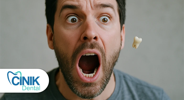 Puoi salvare un dente che è caduto? Ecco tutto ciò che devi sapere! Puoi salvare un dente che è caduto? Ecco tutto ciò che devi sapere!