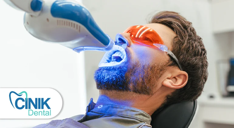 How Much Does Teeth Whitening Cost in Turkey? Everything You Need to Know How Much Does Teeth Whitening Cost in Turkey? Everything You Need to Know