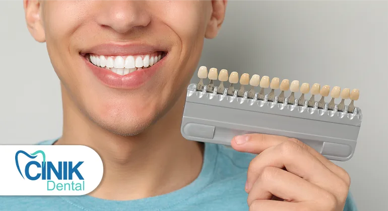 Here’s Why the Cost of Veneers in Turkey Is Such a Sweet Deal Here’s Why the Cost of Veneers in Turkey Is Such a Sweet Deal