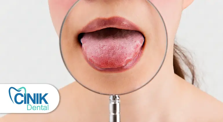 What Your Tongue Reveals About Your Health: A Brief Guide What Your Tongue Reveals About Your Health: A Brief Guide