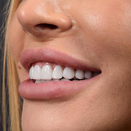 A customized treatment plan