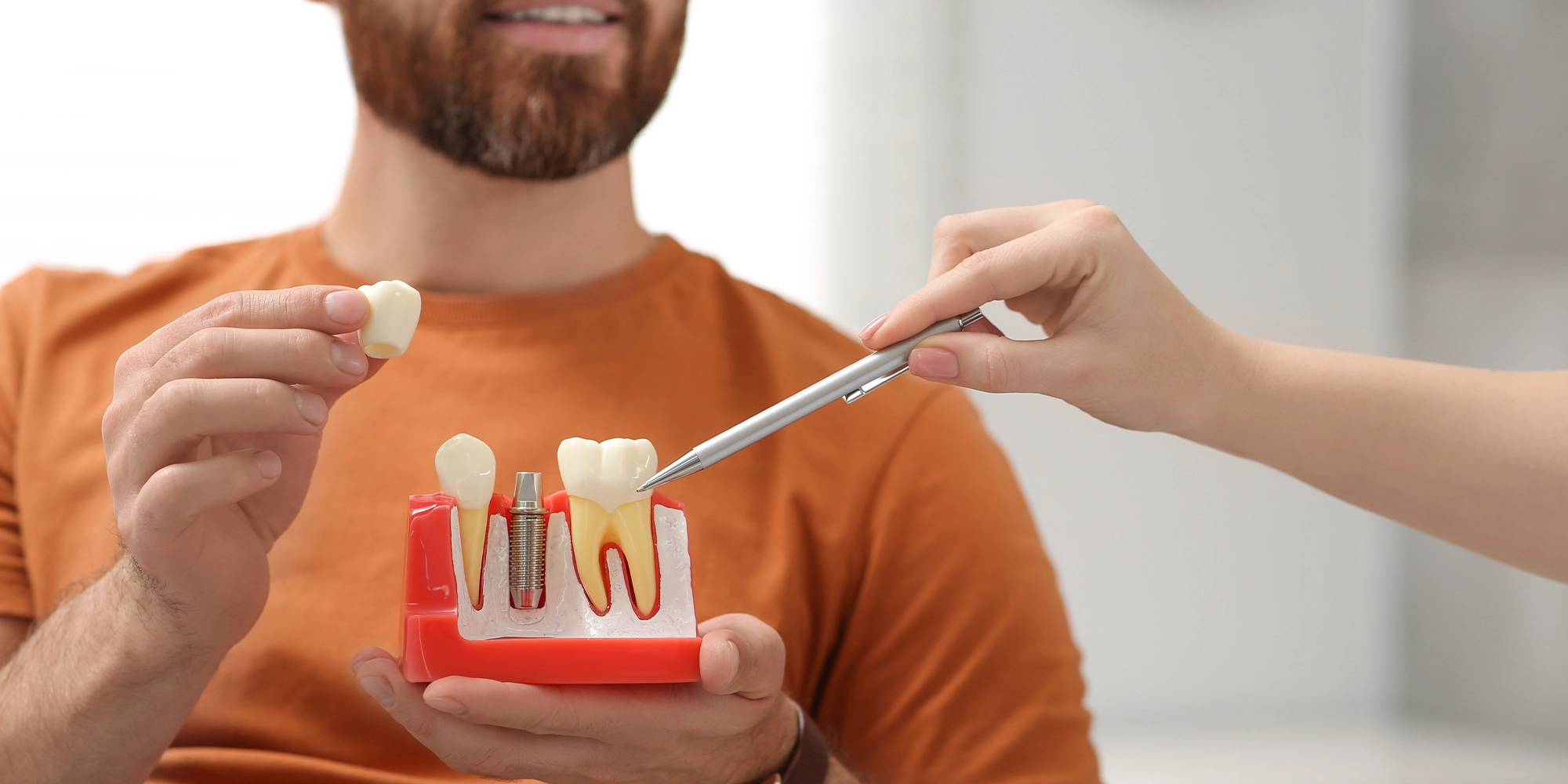 Türkiye'de Diş İmplantı Hakkında Bilmeniz Gerekenler