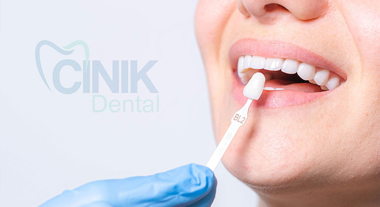 L'indirizzo più accurato in estetica dentale Cinik Dental - Cinik Dental