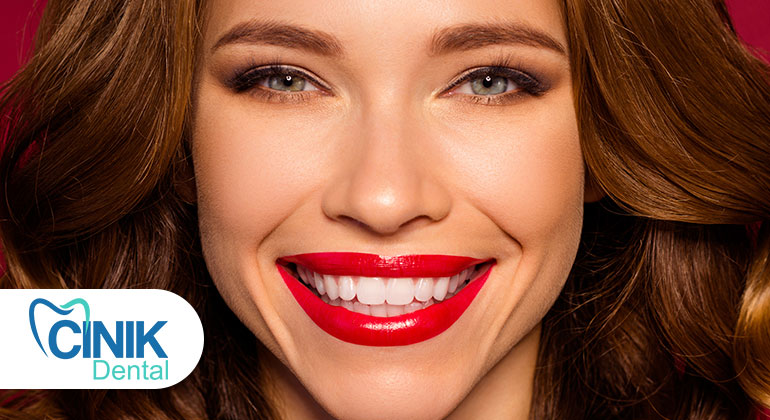 Gülüşünüze Hollywood Dokunuşu: Hollywood Smile İle Işıldayın