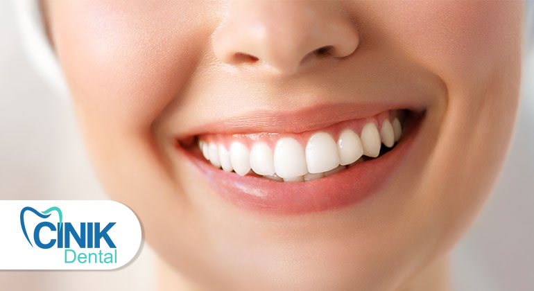 The Colorful World of Teeth Whitening: A Comprehensive Guide