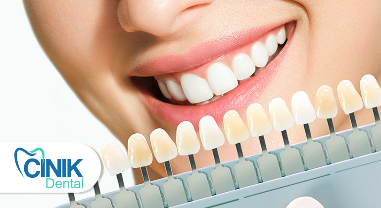 What is dental aesthetics? Who can have dental aesthetics?